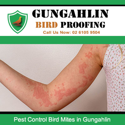 Severe bird mite bites causing red rash on arm requiring pest control in Gungahlin